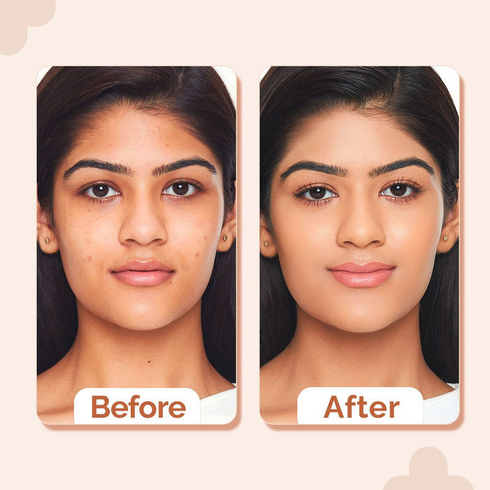 1% Hyaluronic Hydrating High Coverage Foundation - 18ml | Peach